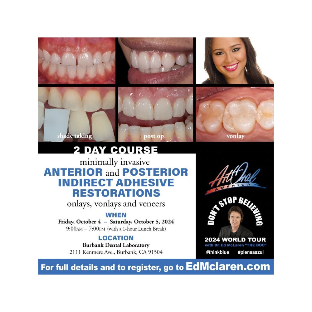 Minimally Invasive Bonded Ceramics Veneers, Onlay and Vonlays
